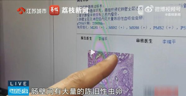 近期高发! 斗争10秒即可感染! 一朝出现这些症状, 立即就医