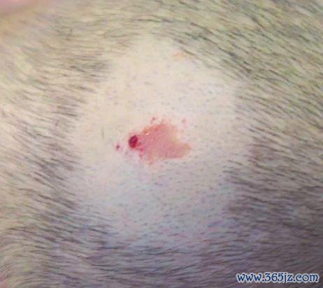 头上的痣遁入癌变风险? 出现这3种情况一定要警惕